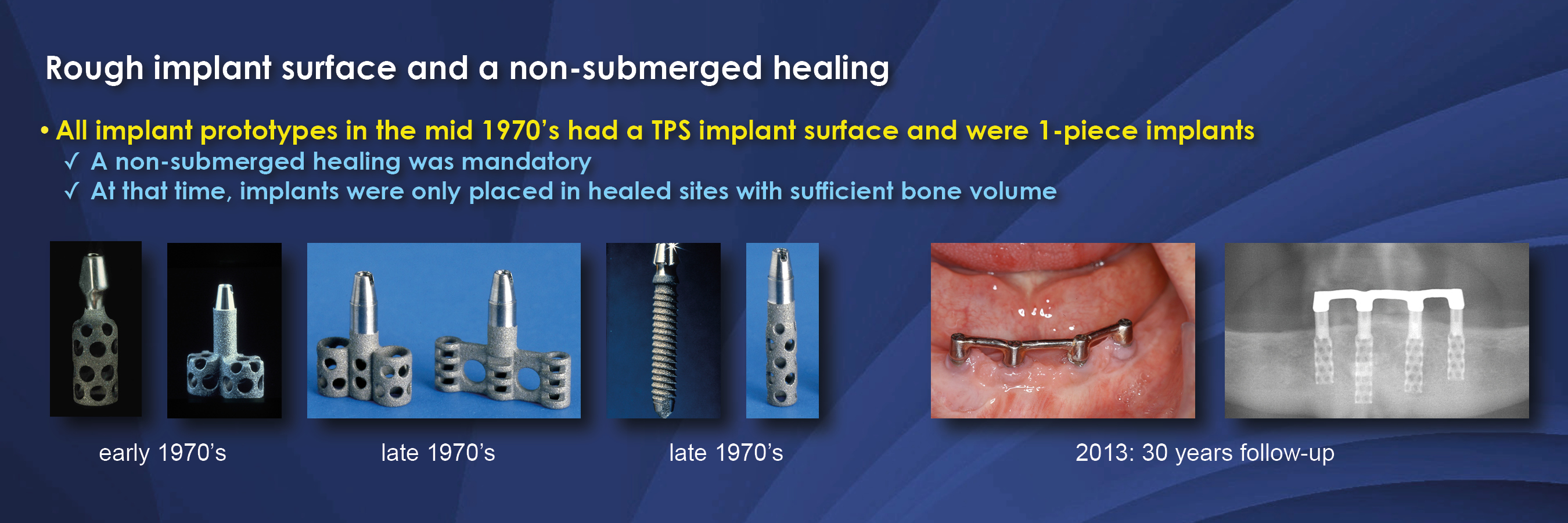 Oral Implantology: Basics， ITI Hollow Cylinder System (Thieme
